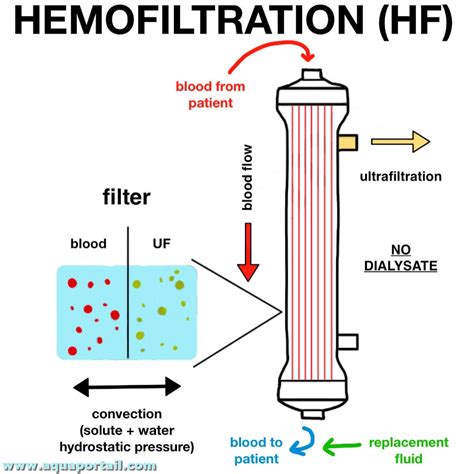 japan hdf|hemofiltration in japan pdf.